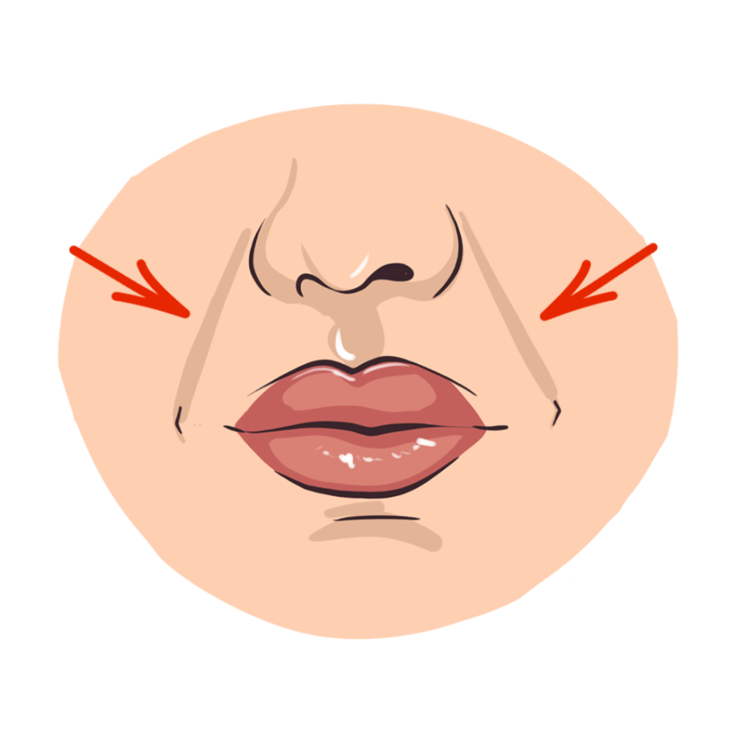 illustration-of-nasolabial-folds-lift-by-Skin-Perfect-Aesthetic-and-wellness