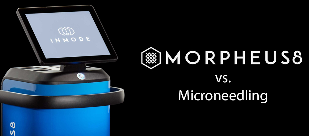 morpheus8-vs-microneedling